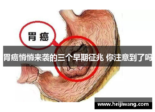 胃癌悄悄来袭的三个早期征兆 你注意到了吗